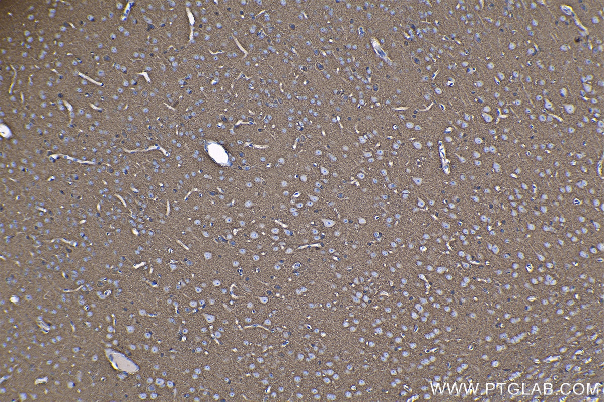 Immunohistochemistry (IHC) staining of mouse brain tissue using SH3GLB2 Polyclonal antibody (15897-1-AP)