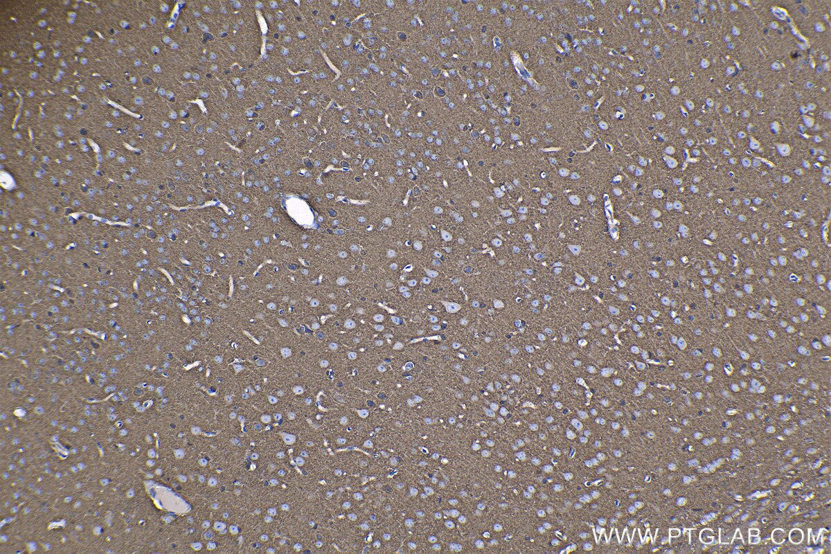 Immunohistochemistry (IHC) staining of mouse brain tissue using SH3GLB2 Polyclonal antibody (15897-1-AP)