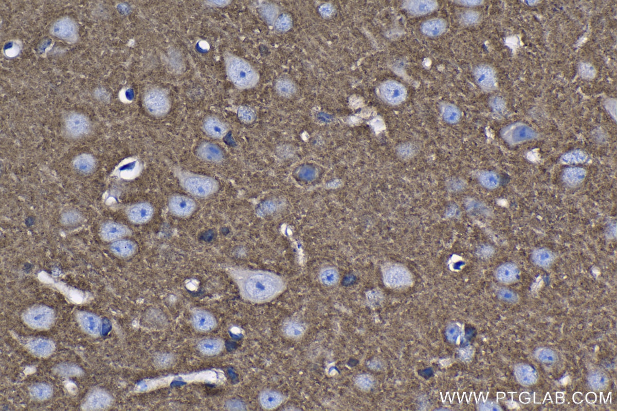 Immunohistochemistry (IHC) staining of mouse brain tissue using SH3GLB2 Polyclonal antibody (15897-1-AP)