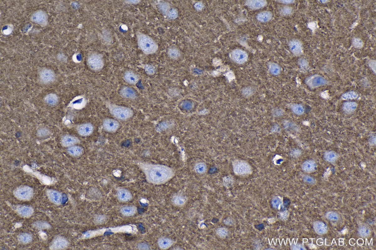 Immunohistochemistry (IHC) staining of mouse brain tissue using SH3GLB2 Polyclonal antibody (15897-1-AP)