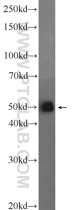 Western Blot (WB) analysis of HeLa cells using SH3GLB2 Polyclonal antibody (15897-1-AP)