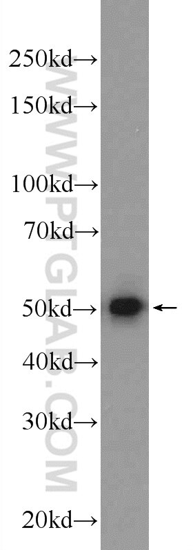 WB analysis of mouse lung using 15897-1-AP