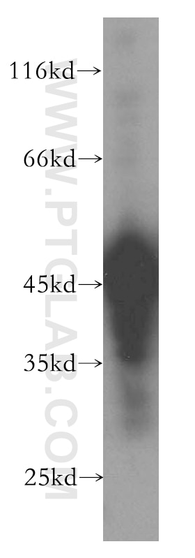Western Blot (WB) analysis of human testis tissue using SH3GLB2 Polyclonal antibody (15897-1-AP)