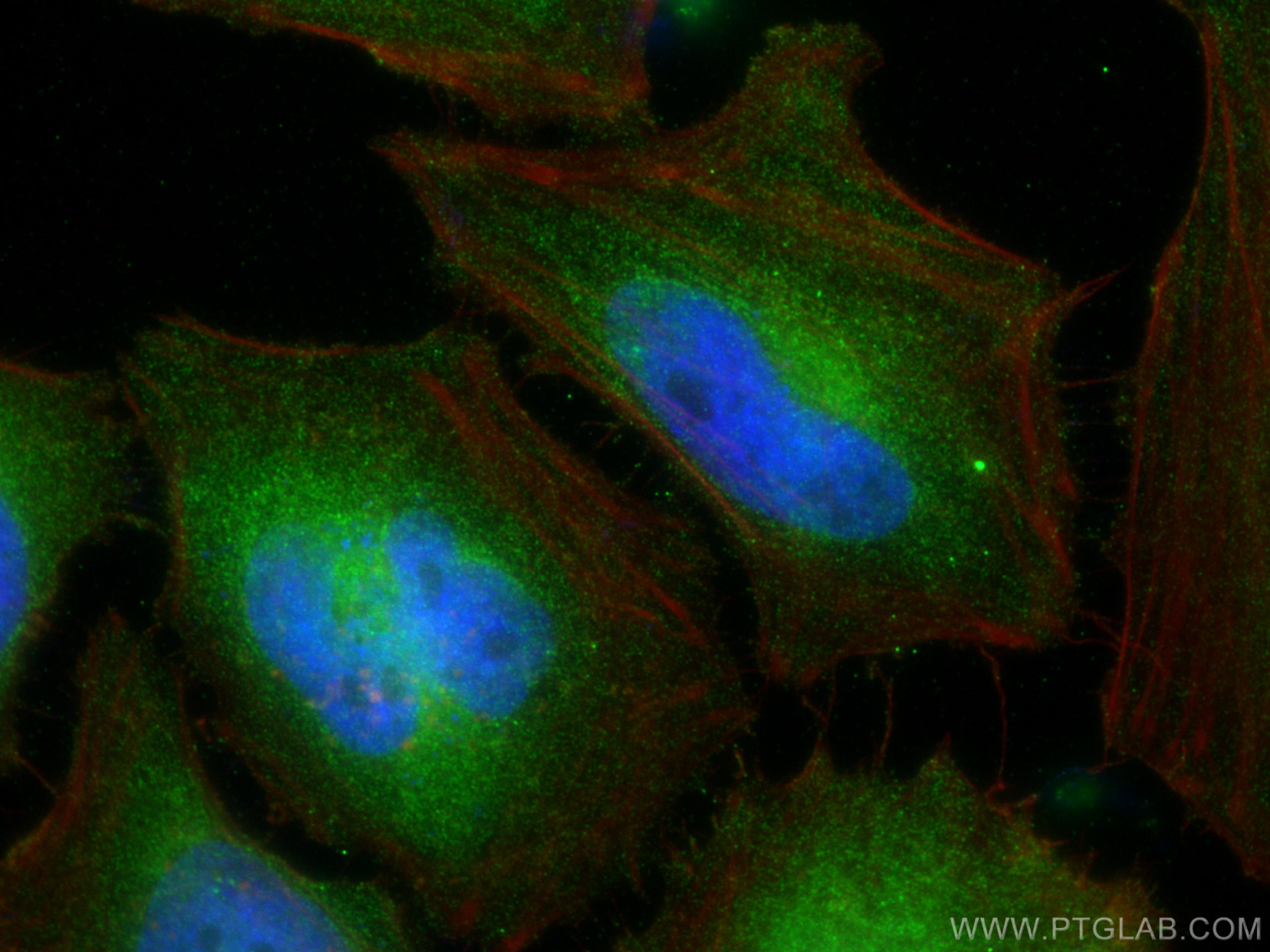 Immunofluorescence (IF) / fluorescent staining of HeLa cells using SH3GLB2 Monoclonal antibody (68325-1-Ig)