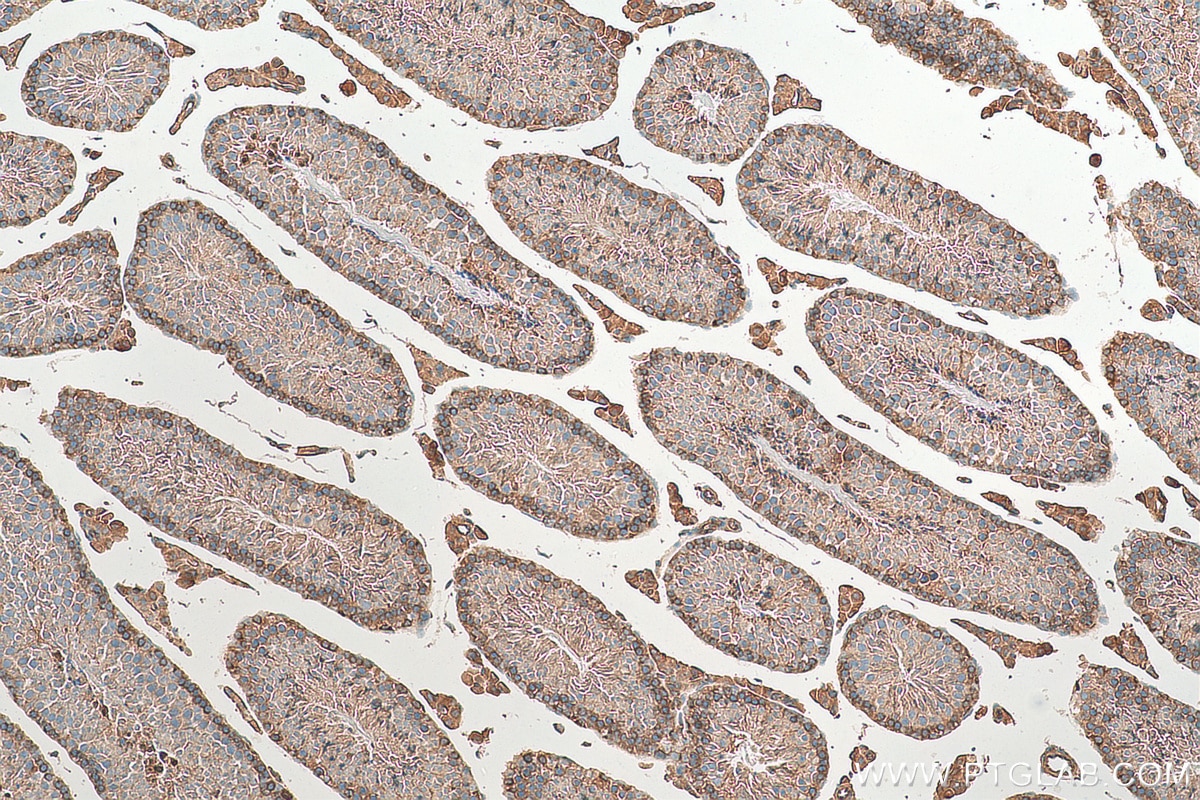 Immunohistochemistry (IHC) staining of mouse testis tissue using SH3GLB2 Monoclonal antibody (68325-1-Ig)