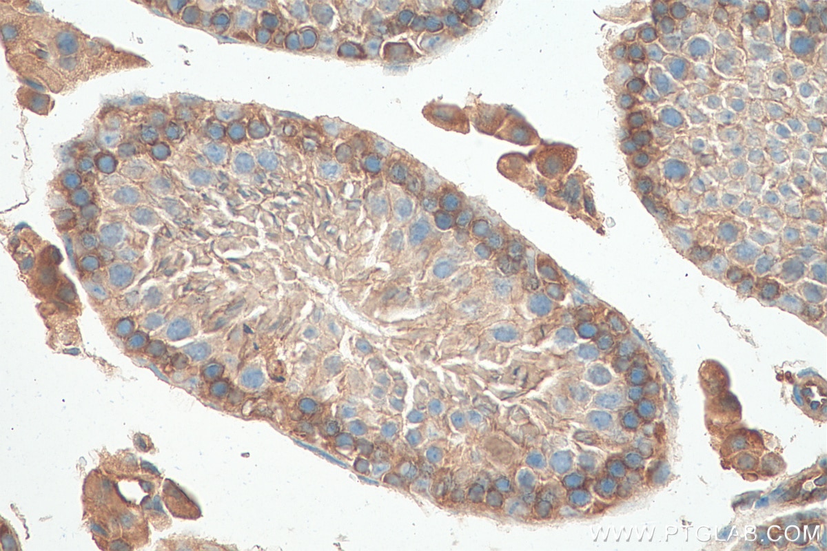 Immunohistochemistry (IHC) staining of mouse testis tissue using SH3GLB2 Monoclonal antibody (68325-1-Ig)