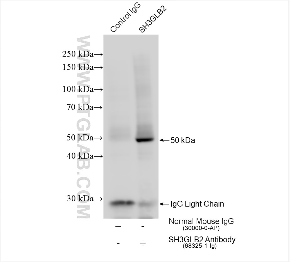 IP experiment of HeLa using 68325-1-Ig