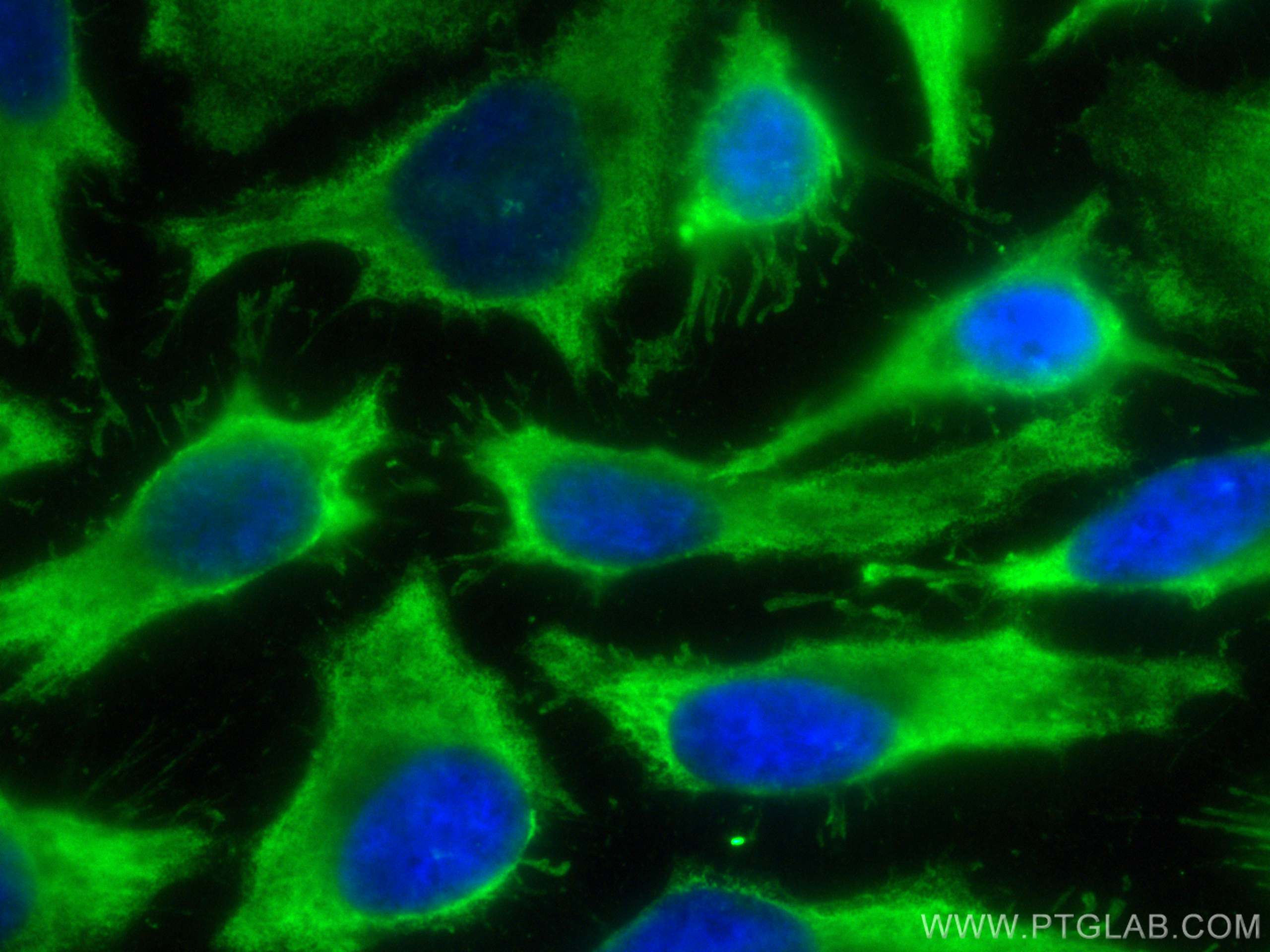 Immunofluorescence (IF) / fluorescent staining of HeLa cells using CoraLite® Plus 488-conjugated SH3GLB2 Monoclonal a (CL488-68325)