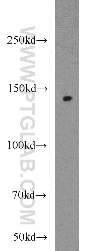 Western Blot (WB) analysis of HepG2 cells using SH3PXD2A Polyclonal antibody (18976-1-AP)