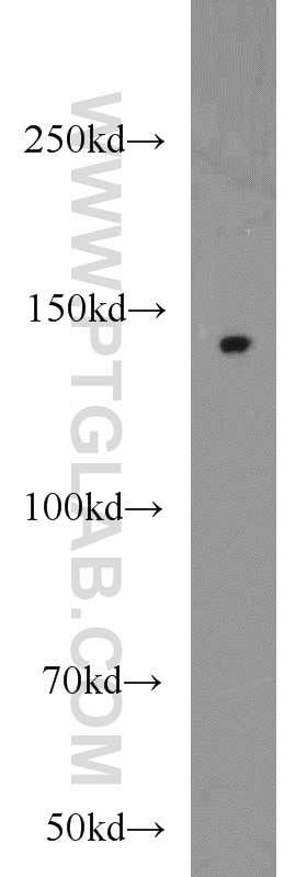 WB analysis of HepG2 using 18976-1-AP