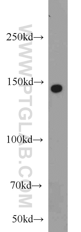 Western Blot (WB) analysis of HeLa cells using SH3PXD2A Polyclonal antibody (18976-1-AP)