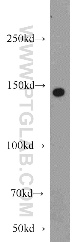 WB analysis of HeLa using 18976-1-AP