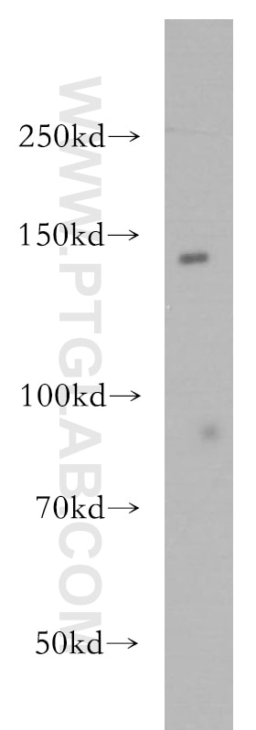 Western Blot (WB) analysis of HepG2 cells using SH3PXD2A Polyclonal antibody (18976-1-AP)