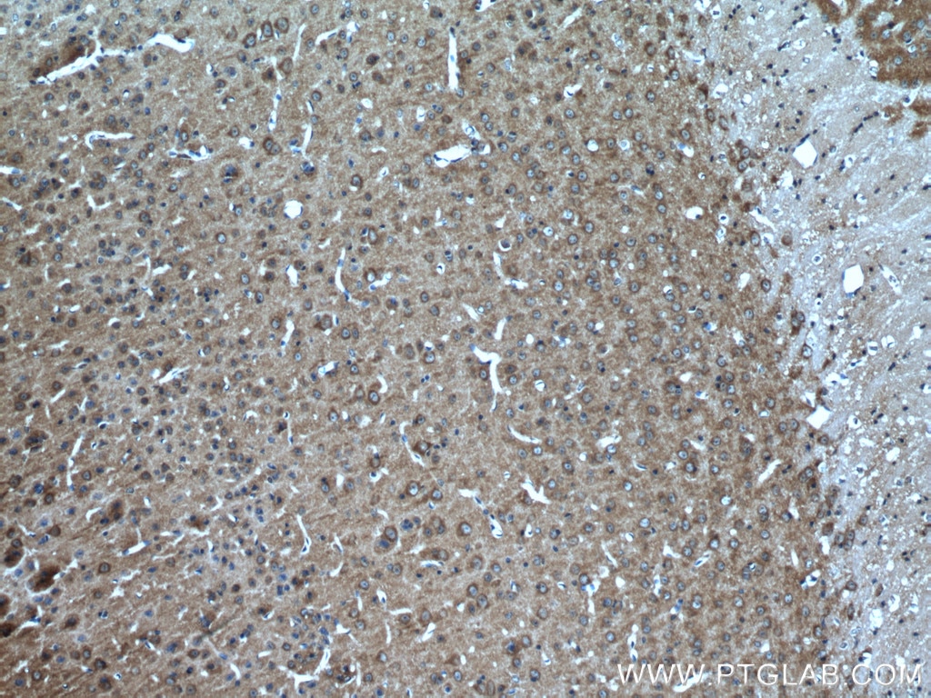 Immunohistochemistry (IHC) staining of mouse brain tissue using POSH Polyclonal antibody (14649-1-AP)