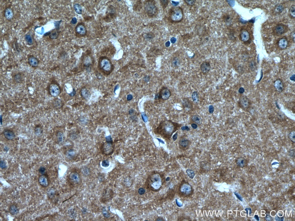 Immunohistochemistry (IHC) staining of mouse brain tissue using POSH Polyclonal antibody (14649-1-AP)