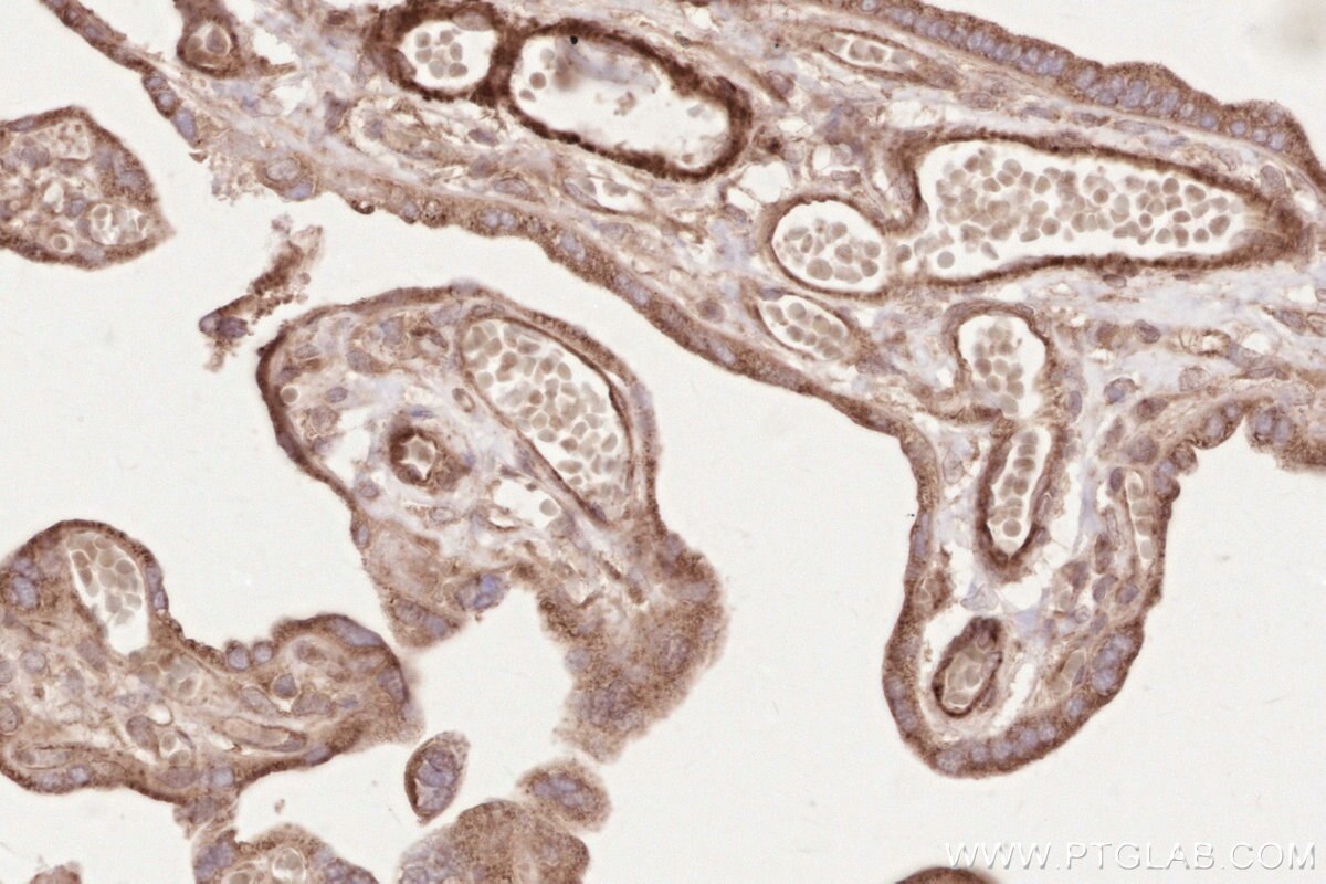 Immunohistochemistry (IHC) staining of human placenta tissue using SH3RF1/POSH Polyclonal antibody (14649-1-AP)