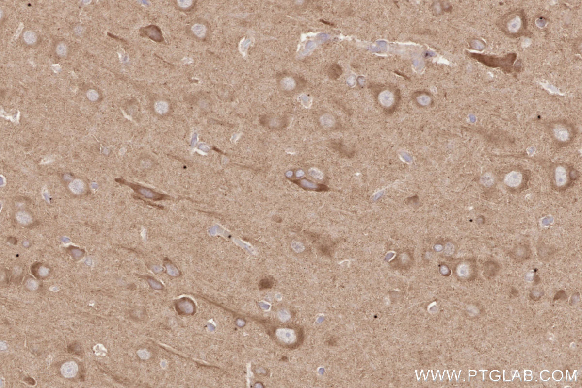 Immunohistochemistry (IHC) staining of rat brain tissue using SH3RF1/POSH Polyclonal antibody (14649-1-AP)