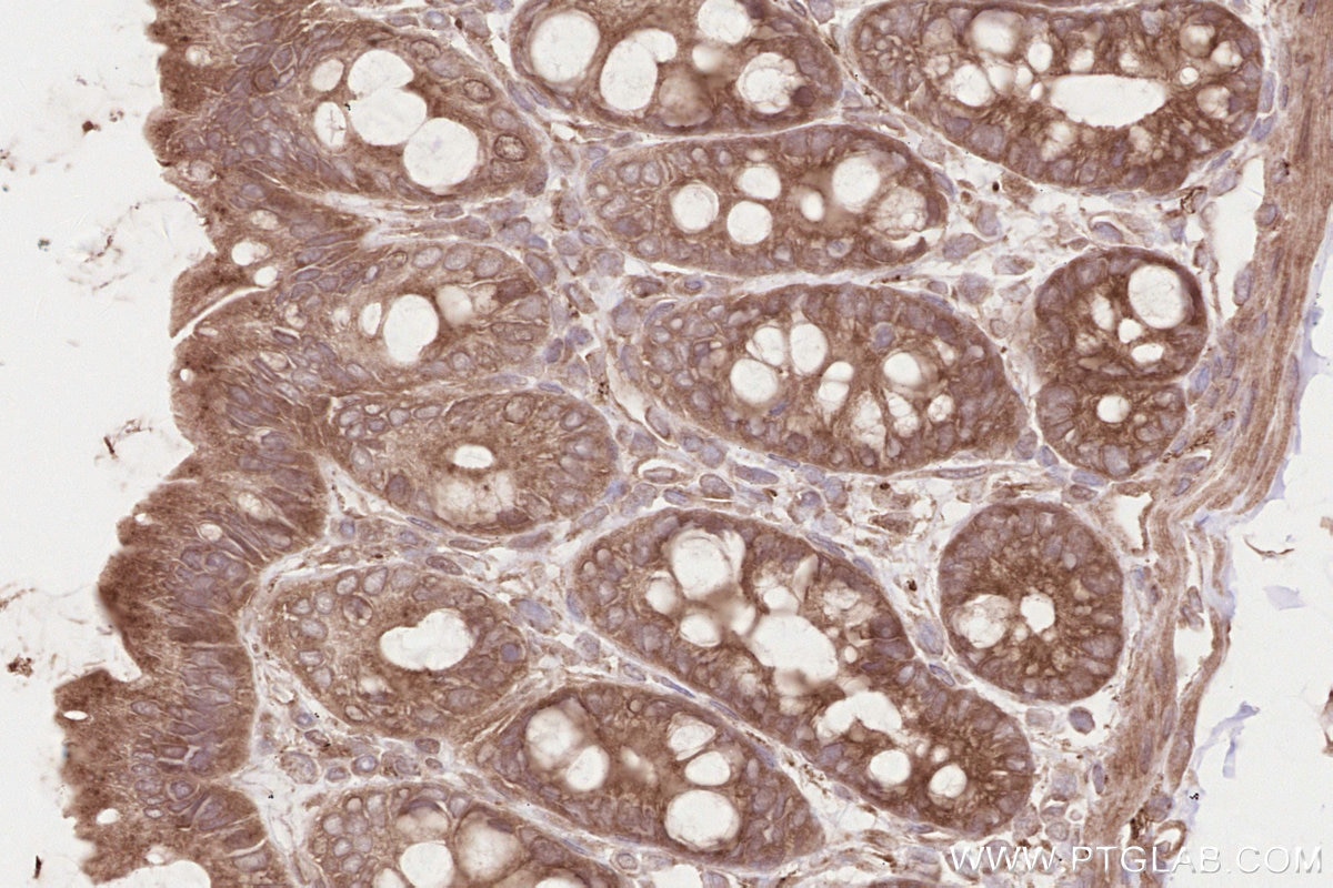 Immunohistochemistry (IHC) staining of rat colon tissue using SH3RF1/POSH Polyclonal antibody (14649-1-AP)