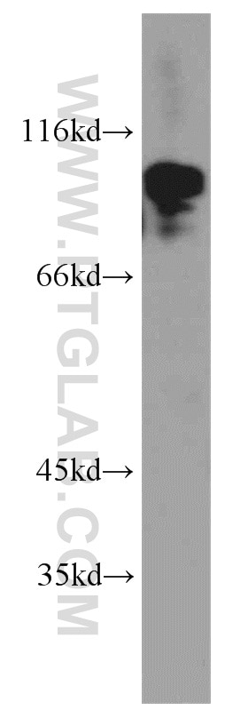 Western Blot (WB) analysis of human brain tissue using POSH Polyclonal antibody (14649-1-AP)