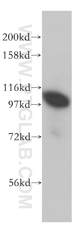 Western Blot (WB) analysis of human brain tissue using POSH Polyclonal antibody (14649-1-AP)