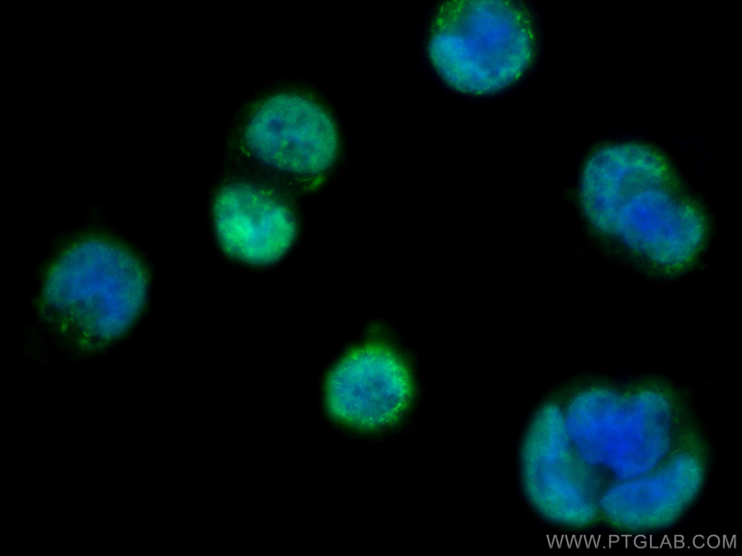 Immunofluorescence (IF) / fluorescent staining of Caco-2 cells using SH3RF2 Polyclonal antibody (13306-1-AP)
