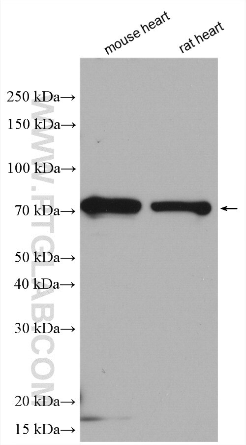 Western Blot (WB) analysis of various lysates using SH3RF2 Polyclonal antibody (13306-1-AP)