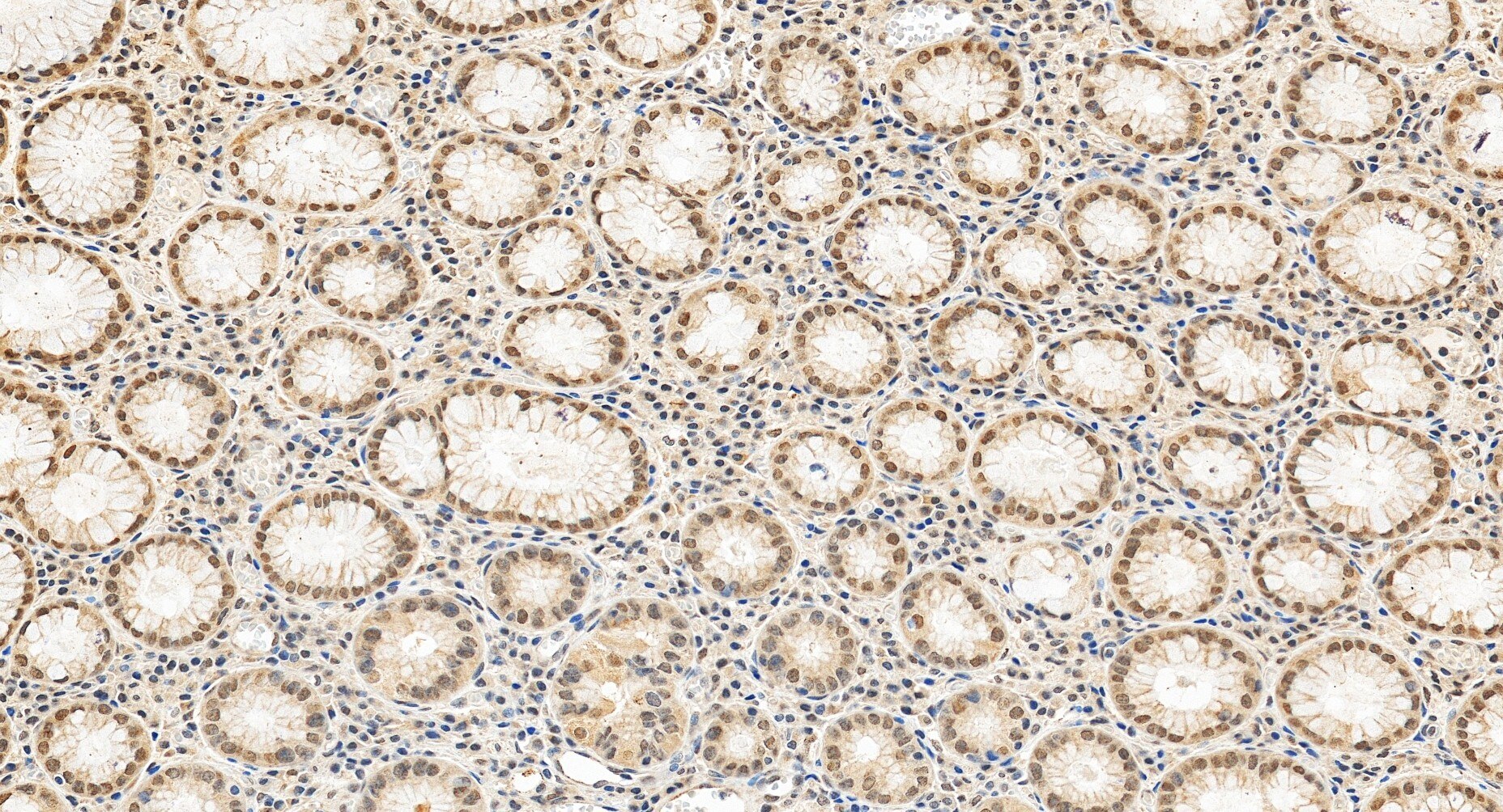 Immunohistochemistry (IHC) staining of human stomach tissue using SH3RF3 Polyclonal antibody (55373-1-AP)