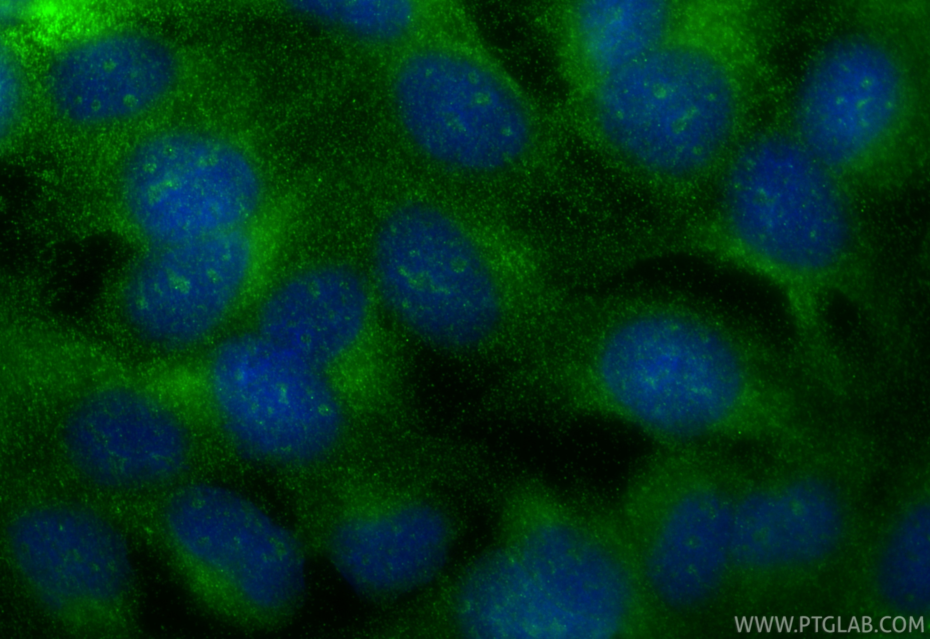 IF Staining of U2OS using 27905-1-AP Immunofluorescence (IF) / fluorescent staining of U2OS cells using SH3TC2 Polyclonal antibody (27905-1-AP)