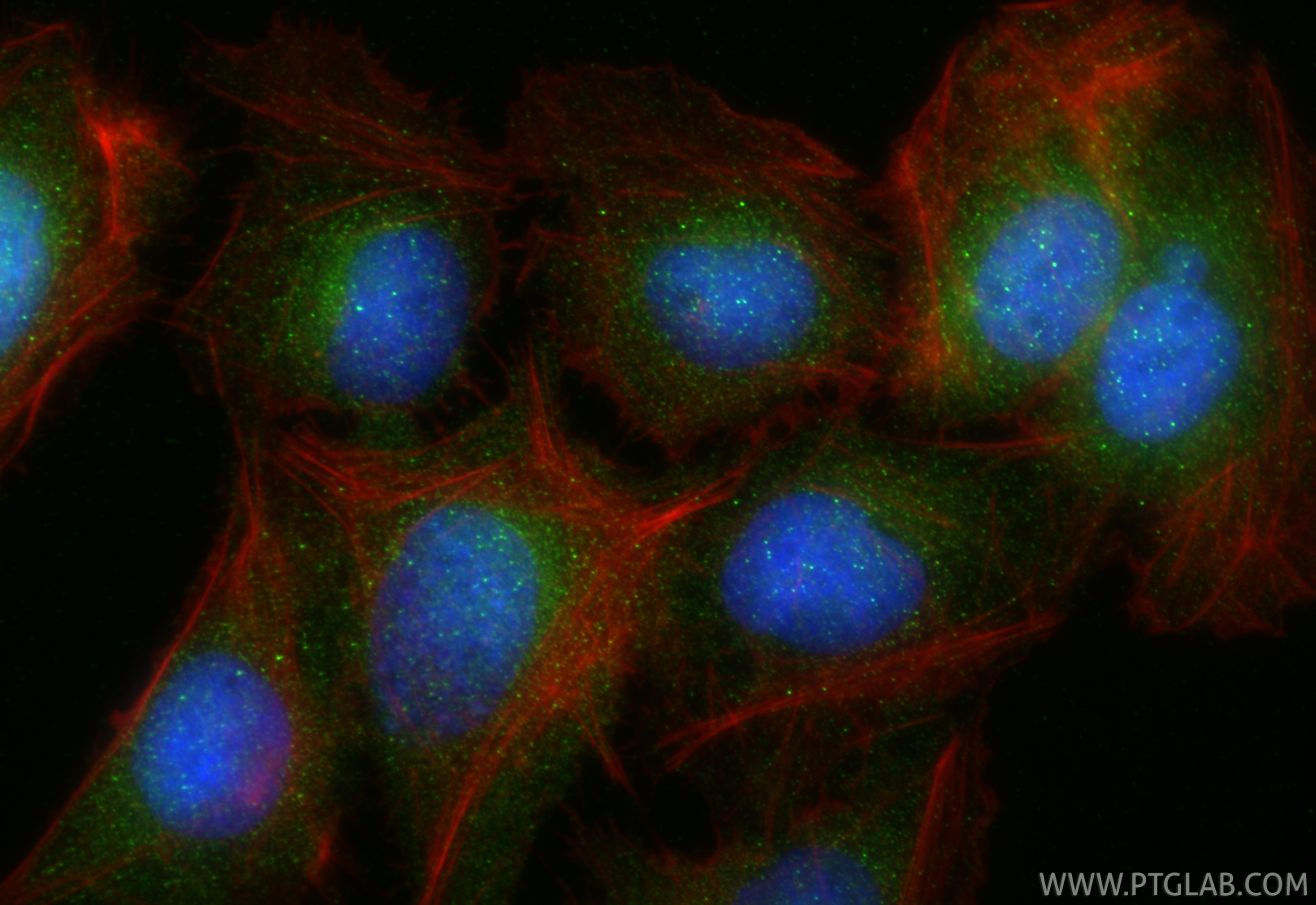 IF Staining of U2OS using 27905-1-AP Immunofluorescence (IF) / fluorescent staining of U2OS cells using SH3TC2 Polyclonal antibody (27905-1-AP)