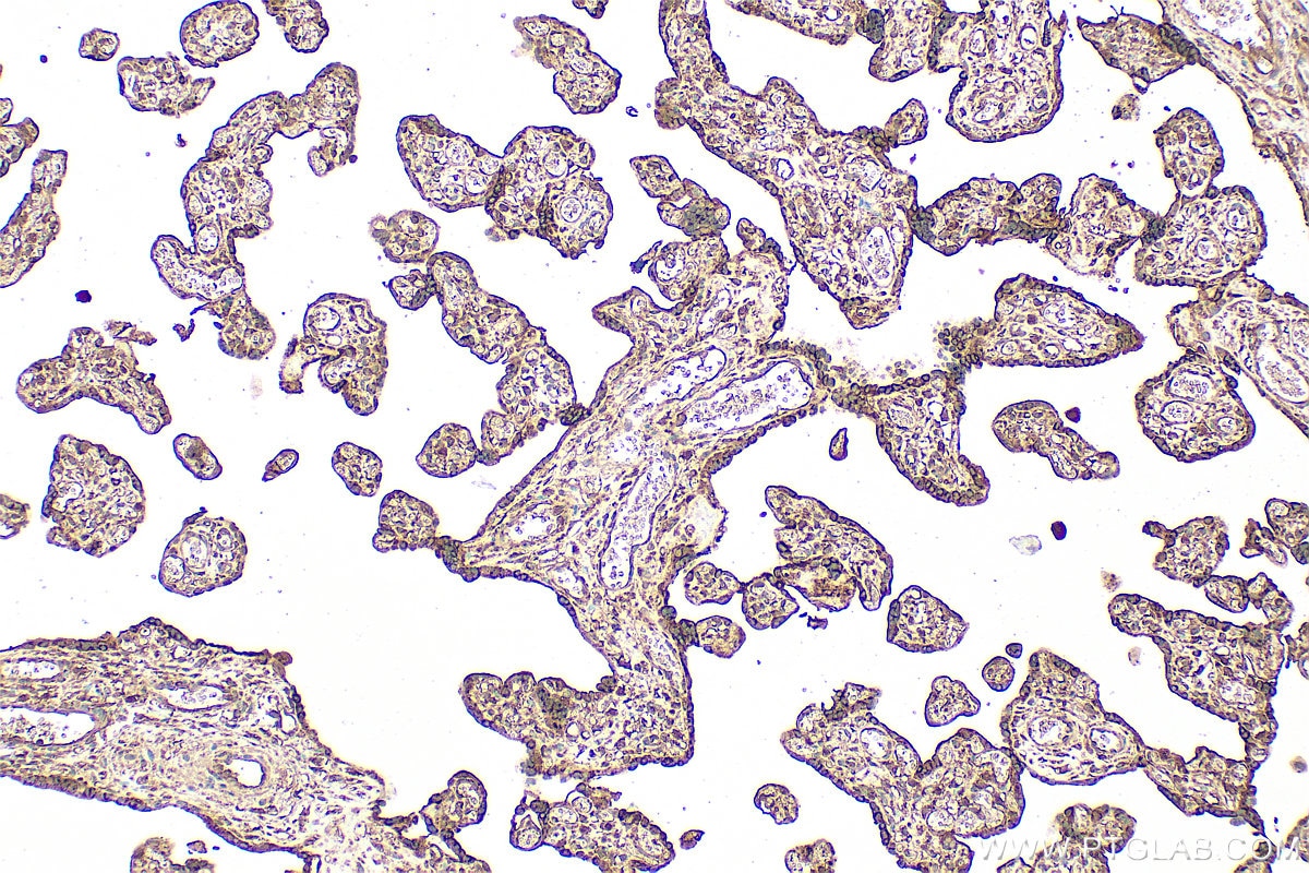 IHC staining of human placenta using 27905-1-AP Immunohistochemistry (IHC) staining of human placenta tissue using SH3TC2 Polyclonal antibody (27905-1-AP)