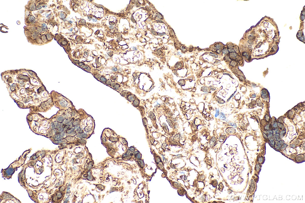 IHC staining of human placenta using 27905-1-AP Immunohistochemistry (IHC) staining of human placenta tissue using SH3TC2 Polyclonal antibody (27905-1-AP)