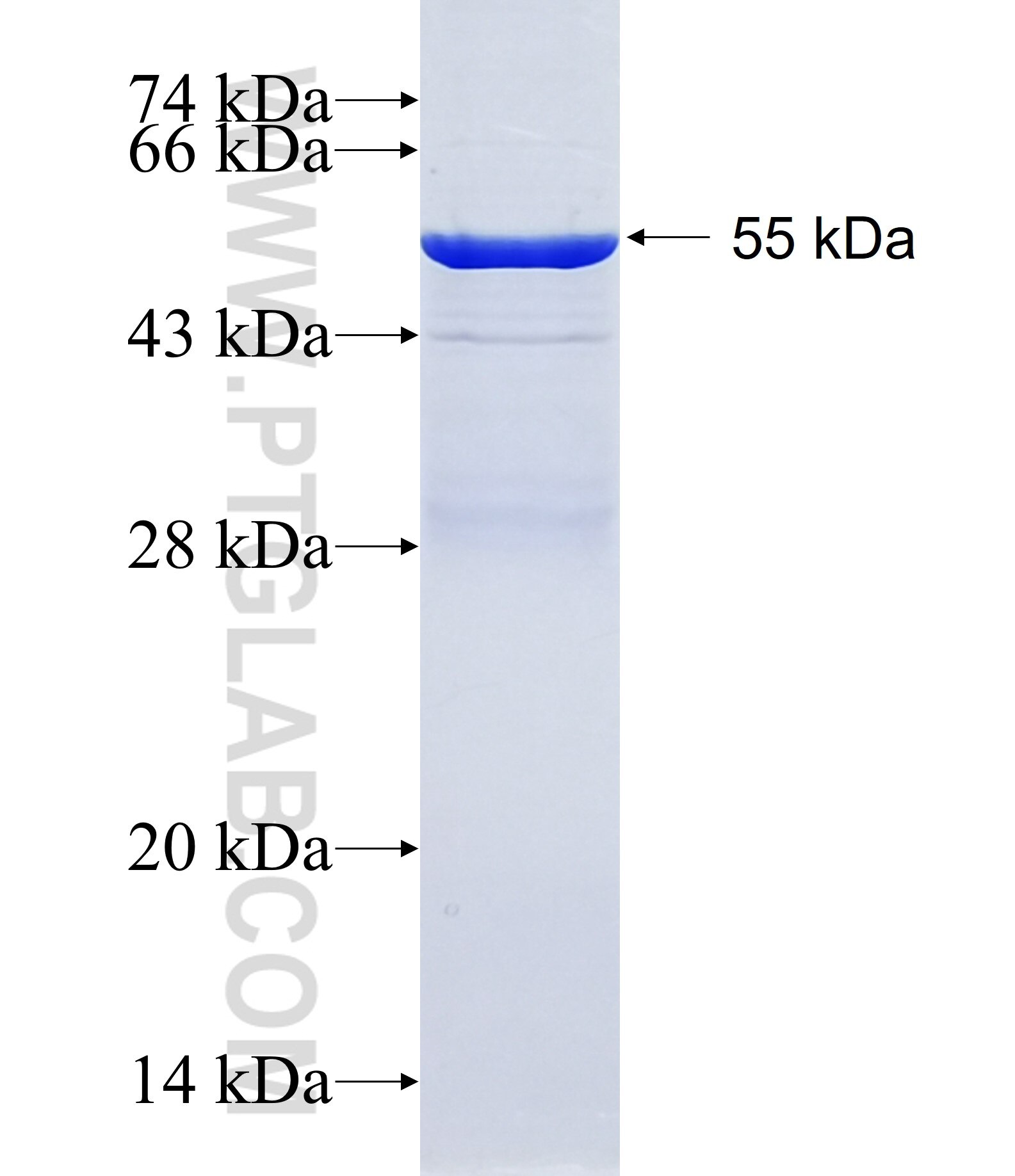 SH3TC2 fusion protein Ag27352 SDS-PAGE