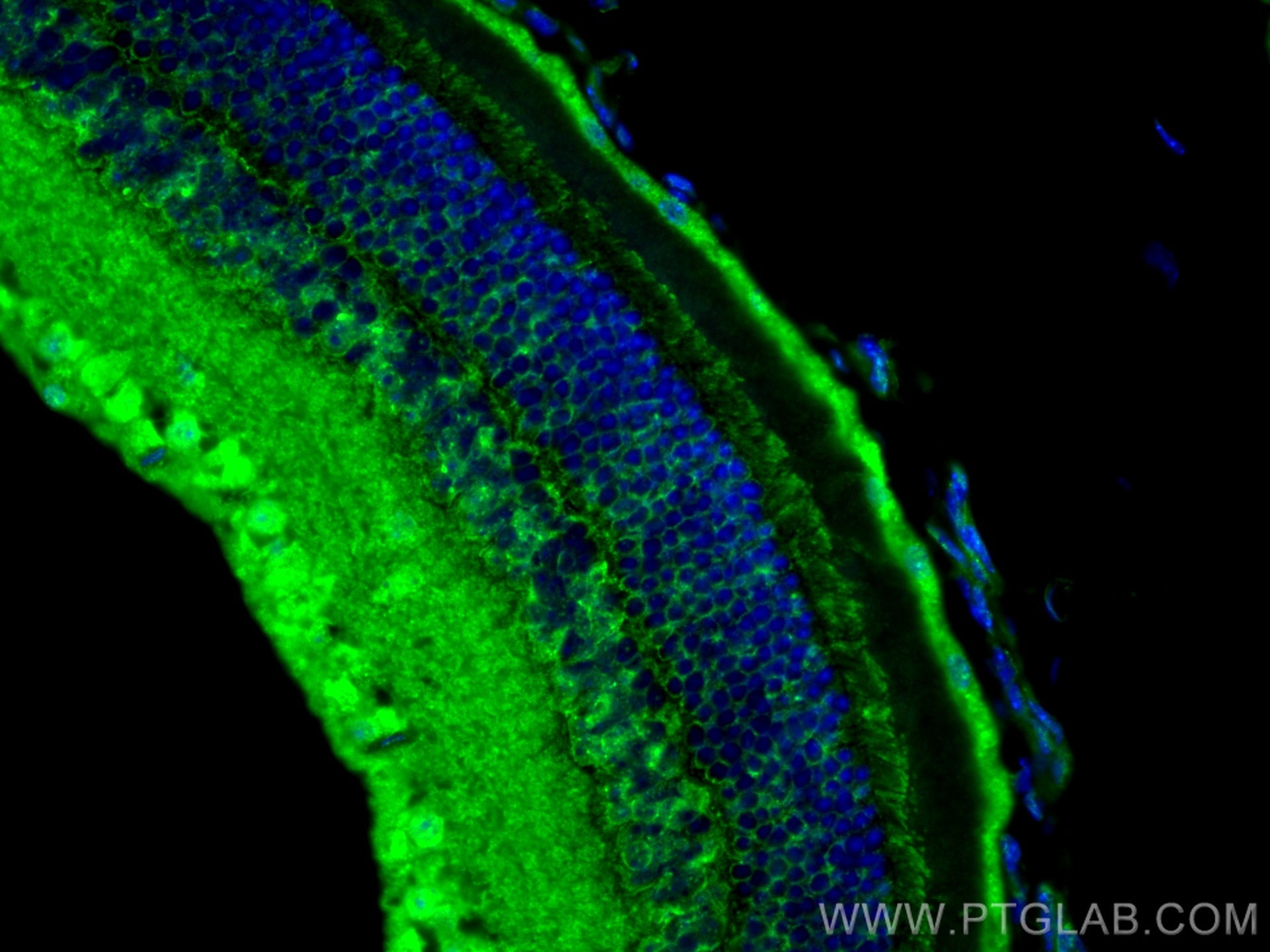 Immunofluorescence (IF) / fluorescent staining of mouse eye tissue using SHANK1 Polyclonal antibody (55059-1-AP)