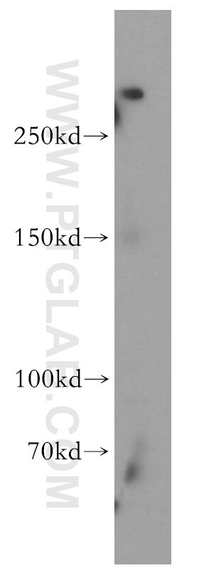 SHANK1 Polyclonal antibody