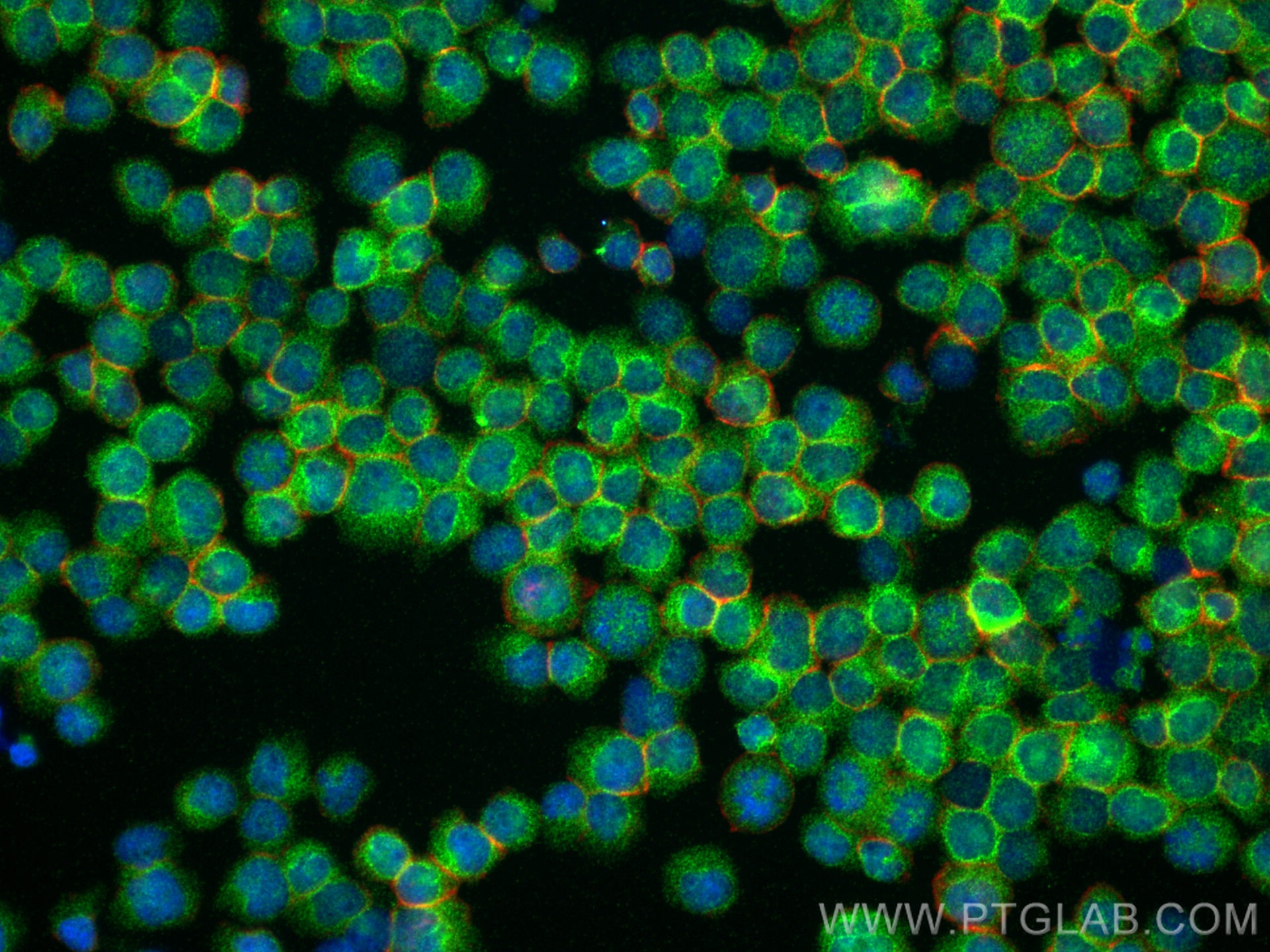 Immunofluorescence (IF) / fluorescent staining of Jurkat cells using SHARPIN Polyclonal antibody (14626-1-AP)