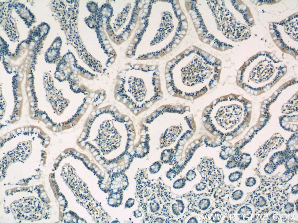 Immunohistochemistry (IHC) staining of human small intestine tissue using SHARPIN Polyclonal antibody (14626-1-AP)
