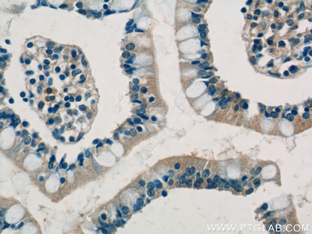 Immunohistochemistry (IHC) staining of human small intestine tissue using SHARPIN Polyclonal antibody (14626-1-AP)