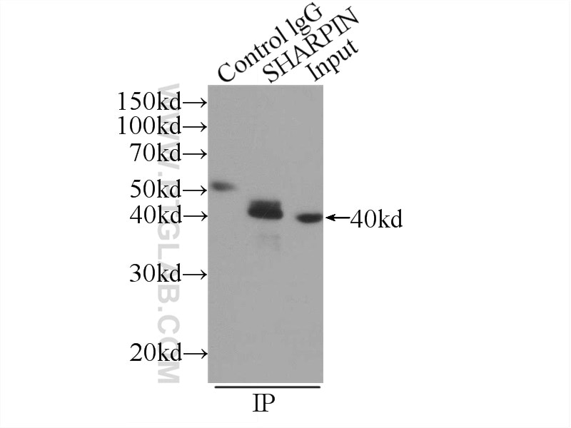 Immunoprecipitation (IP) experiment of Raji cells using SHARPIN Polyclonal antibody (14626-1-AP)