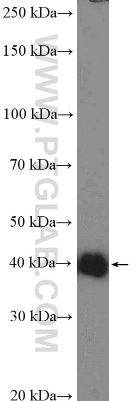 Western Blot (WB) analysis of Jurkat cells using SHARPIN Polyclonal antibody (14626-1-AP)