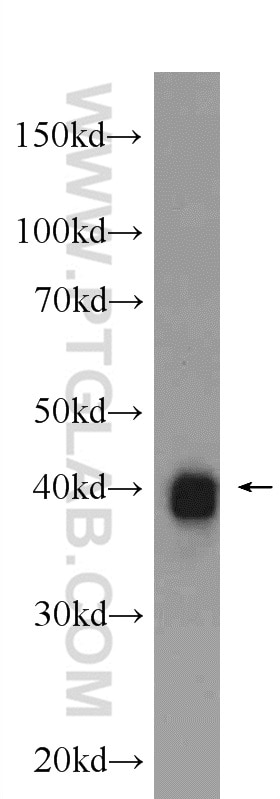 Western Blot (WB) analysis of mouse brain tissue using SHARPIN Polyclonal antibody (14626-1-AP)