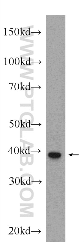 Western Blot (WB) analysis of mouse skeletal muscle tissue using SHARPIN Polyclonal antibody (14626-1-AP)
