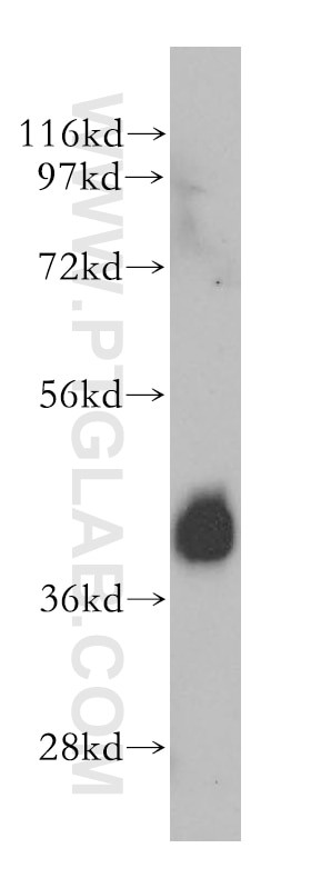 Western Blot (WB) analysis of A549 cells using SHARPIN Polyclonal antibody (14626-1-AP)