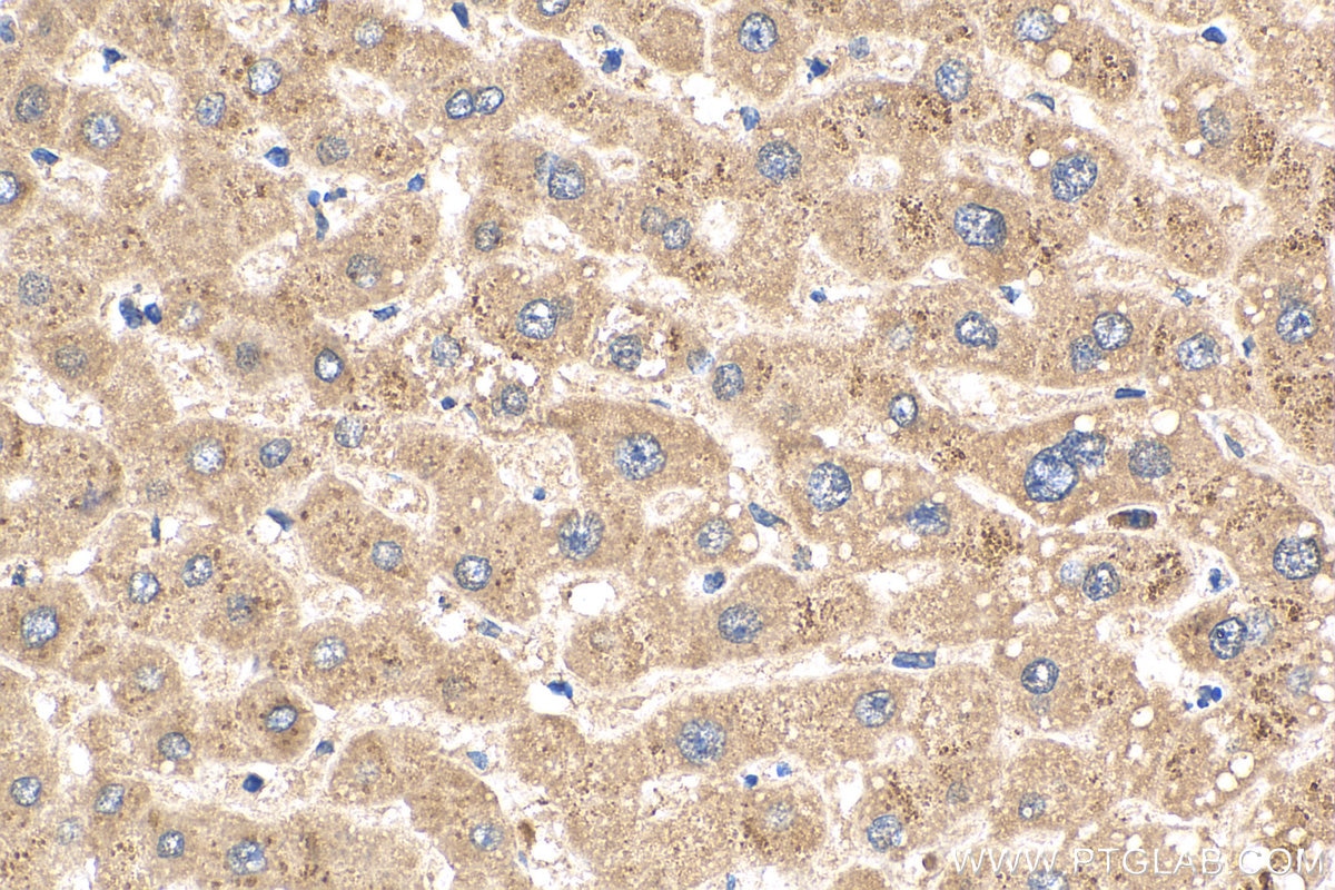 Immunohistochemistry (IHC) staining of human liver tissue using SHBG Polyclonal antibody (18200-1-AP)