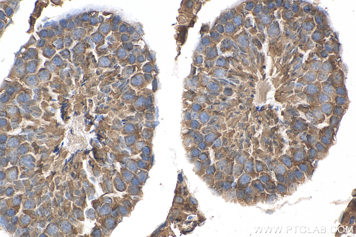 Immunohistochemistry (IHC) staining of mouse testis tissue using SHBG Polyclonal antibody (18200-1-AP)