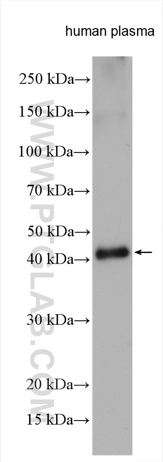 Western Blot (WB) analysis of various lysates using SHBG Polyclonal antibody (18200-1-AP)