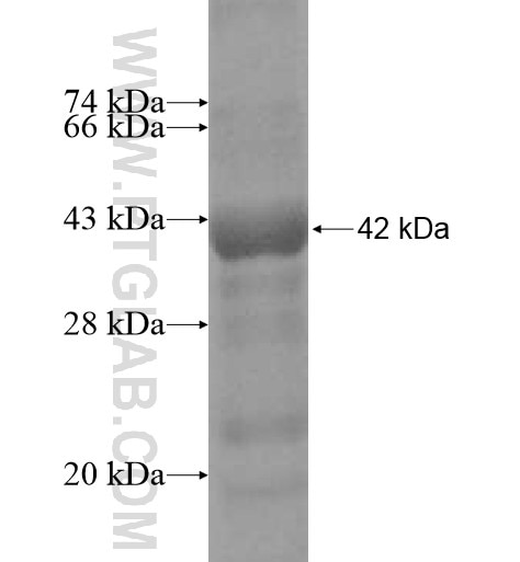 SHBG fusion protein Ag12683 SDS-PAGE