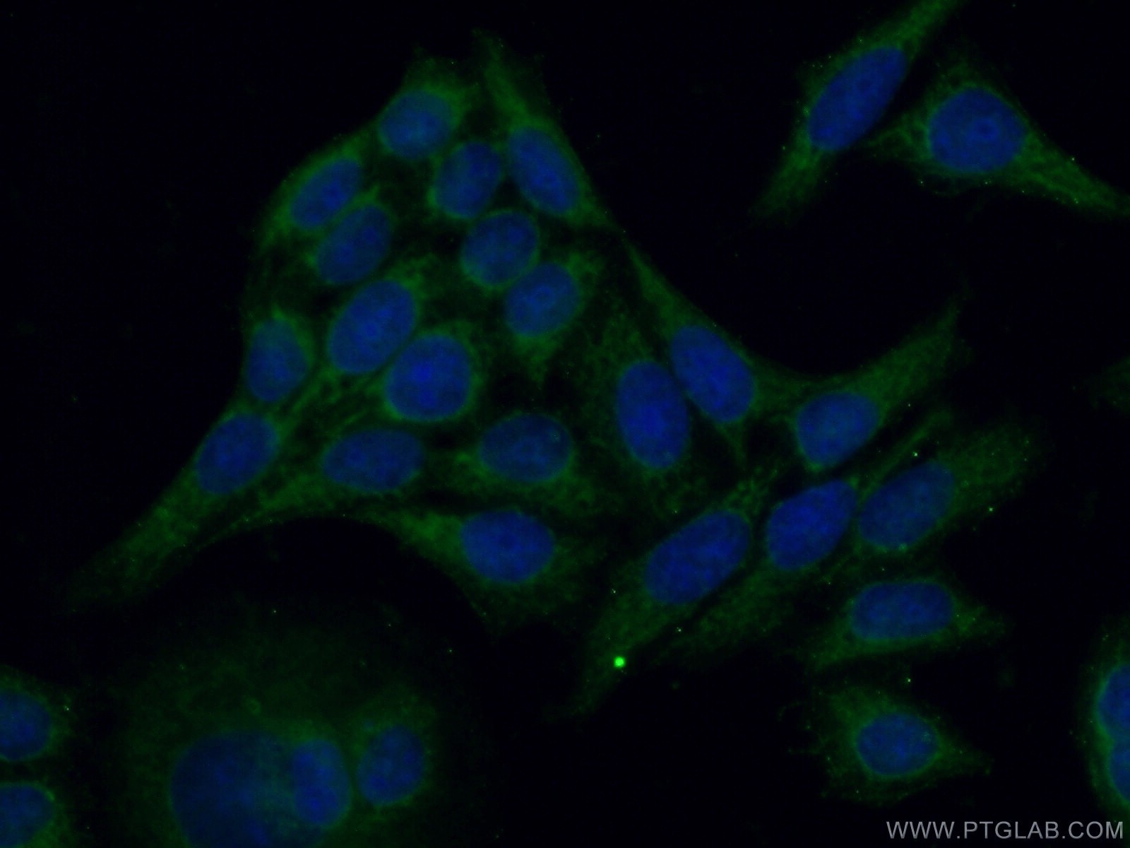 Immunofluorescence (IF) / fluorescent staining of HeLa cells using SHC Polyclonal antibody (10054-1-AP)