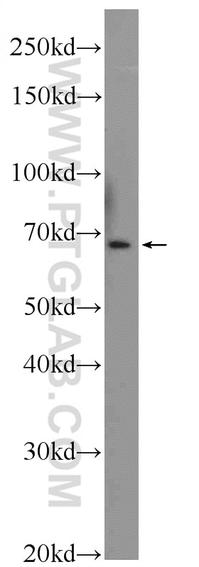 Western Blot (WB) analysis of mouse skin tissue using SHC Polyclonal antibody (10054-1-AP)