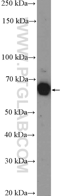 Western Blot (WB) analysis of A431 cells using SHC Polyclonal antibody (10054-1-AP)