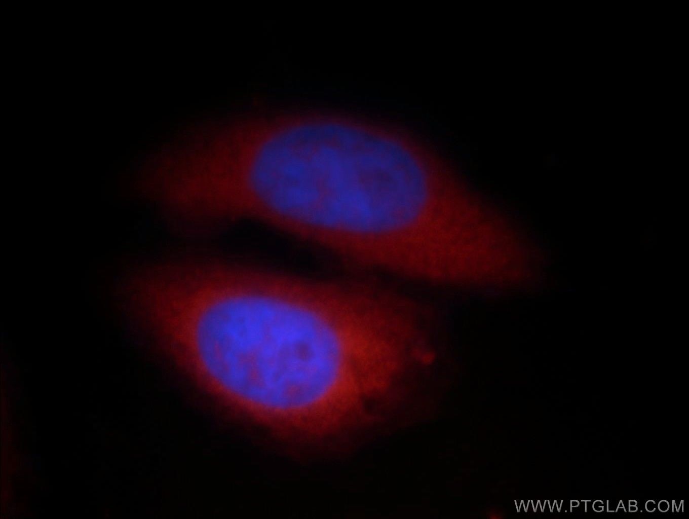 Immunofluorescence (IF) / fluorescent staining of HepG2 cells using SHC Polyclonal antibody (12496-1-AP)